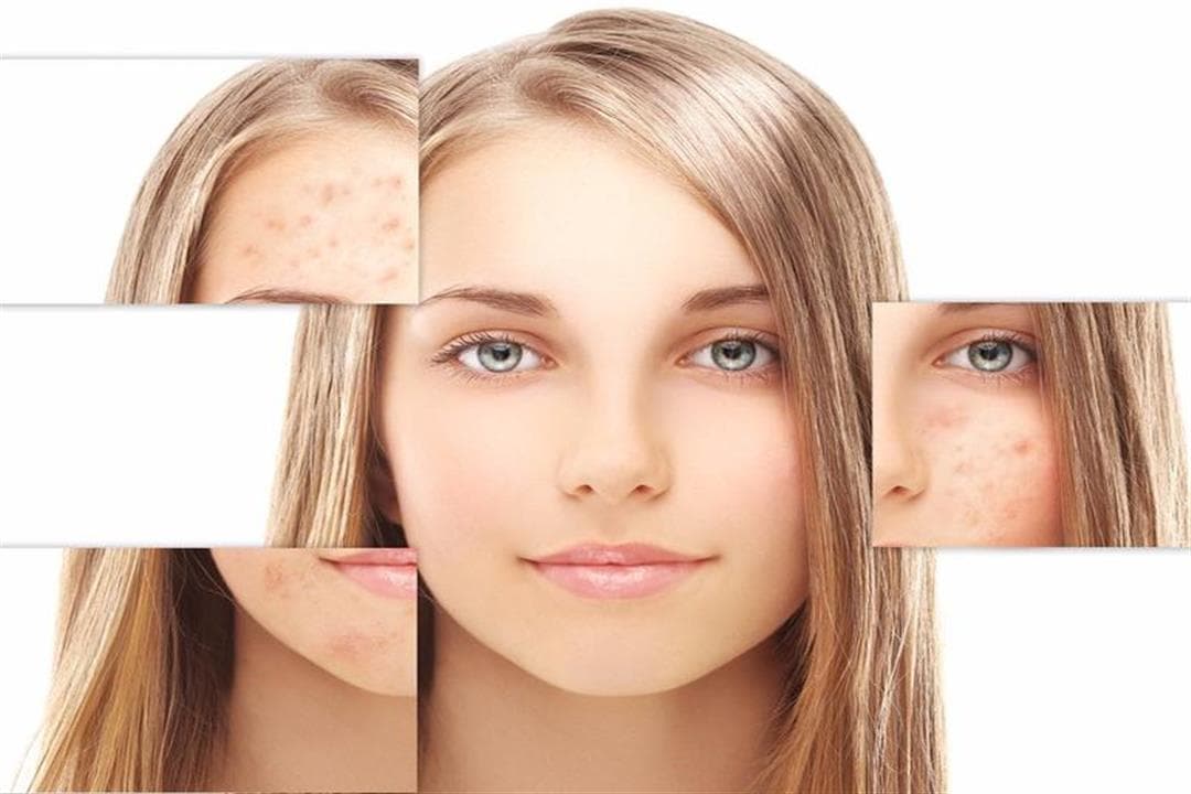 Editorial image for: Skin pigmentation: types and treatment methods