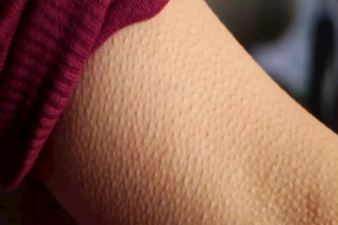 صورة توضيحية عن الشعر وفروة الرأس