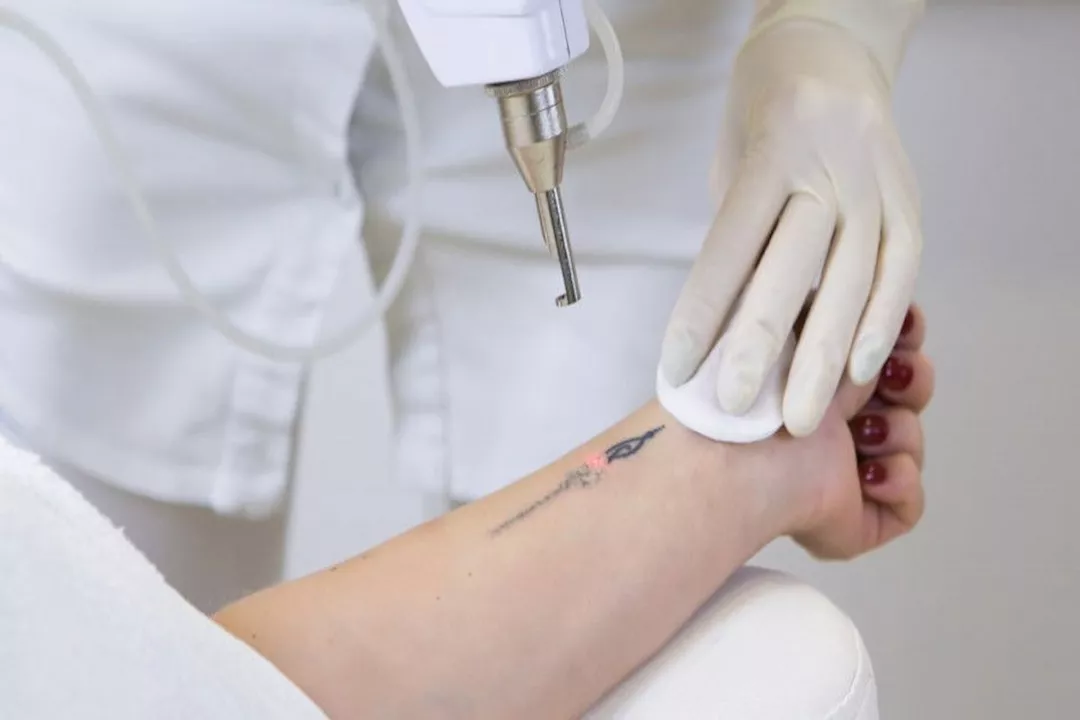 Editorial image for: Health risks of permanent and temporary tattoos