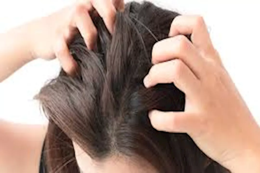 Editorial image for: Effective ways to control an oily scalp