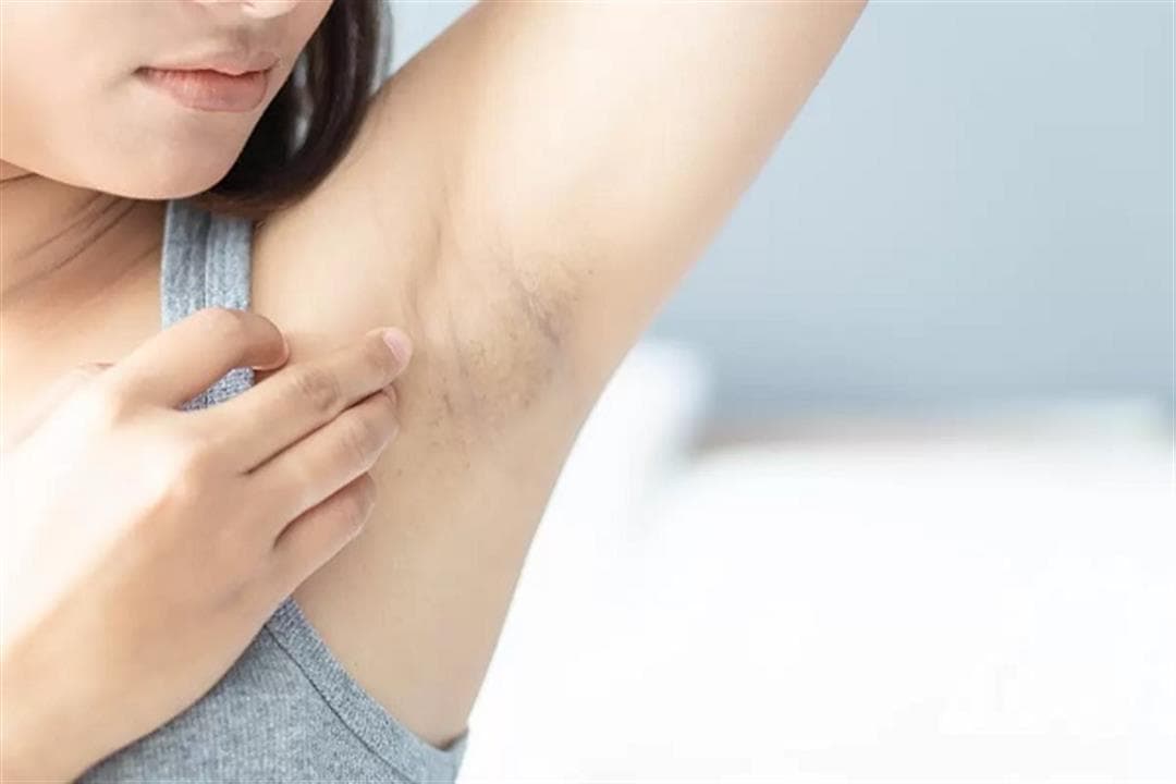 Editorial image for: Care routine for sensitive areas to prevent darkening (Video)